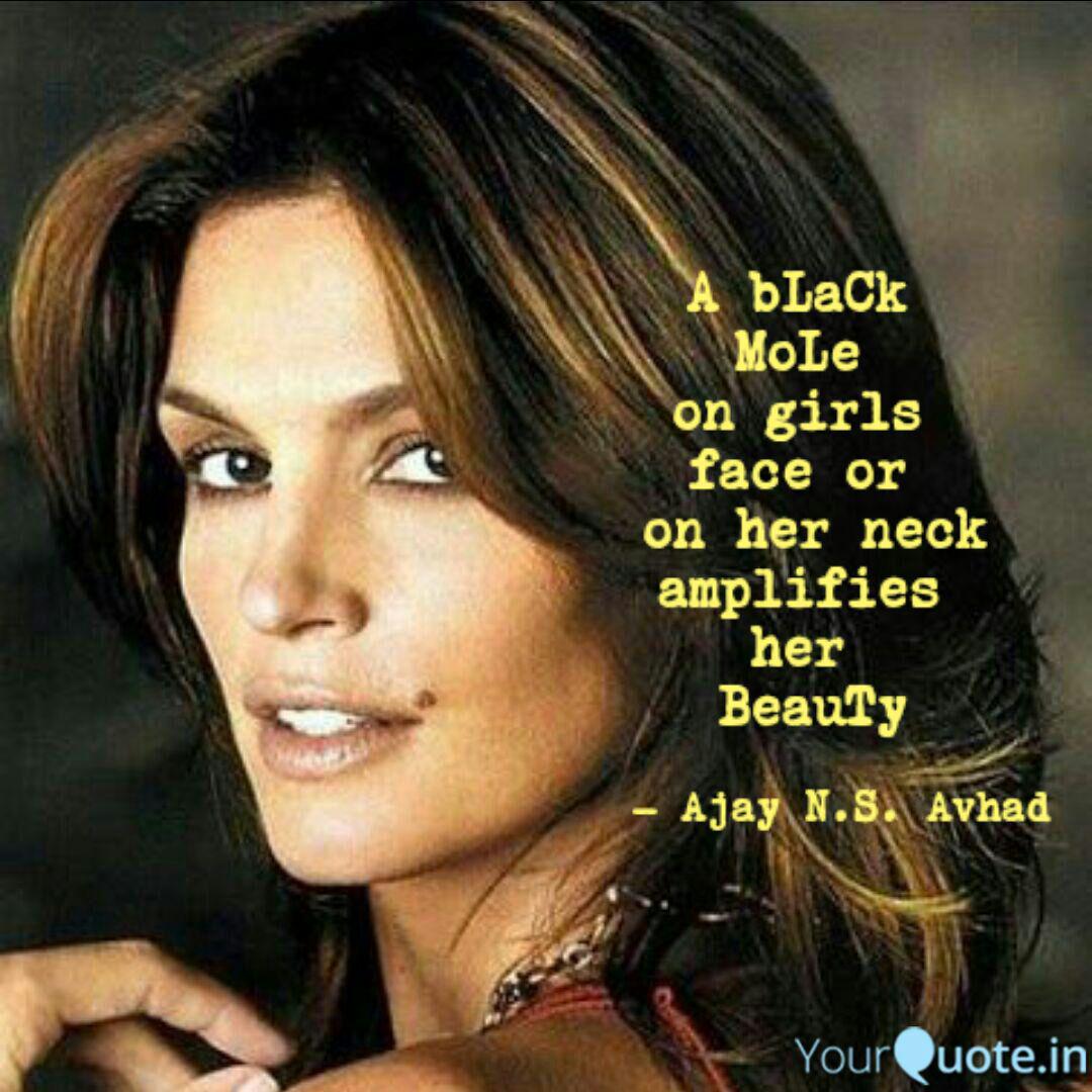 A Black Mole On Girls ... | Quotes & Writings By Ajay Nirmala Sampat Avhad | Yourquote